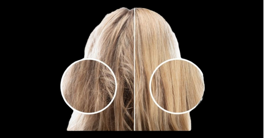 10 Hair Care Habits That Can Damage Your Hair & How to Prevent it